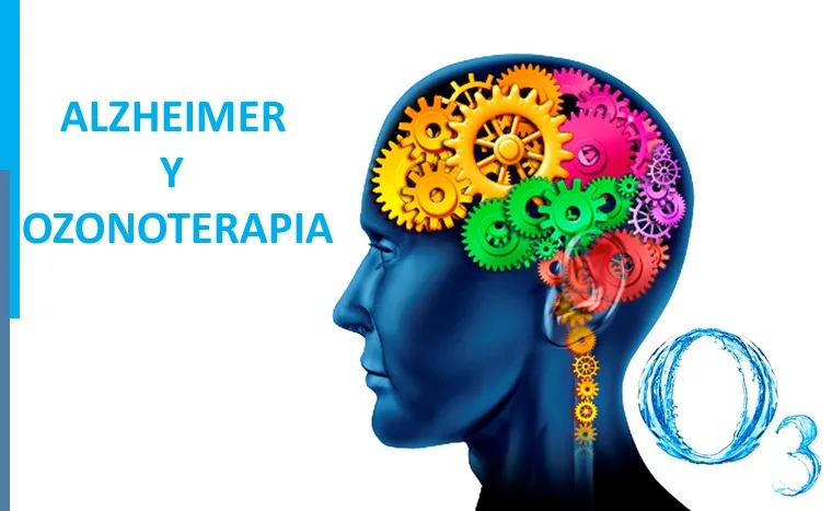 Alzheimer y ozonoterapia
